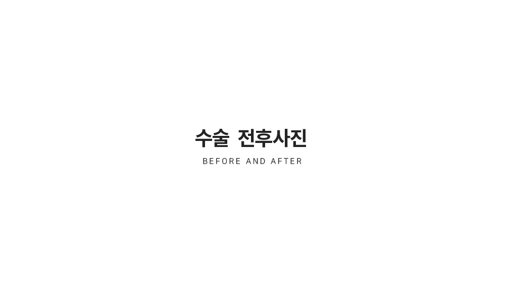 리나성형외과