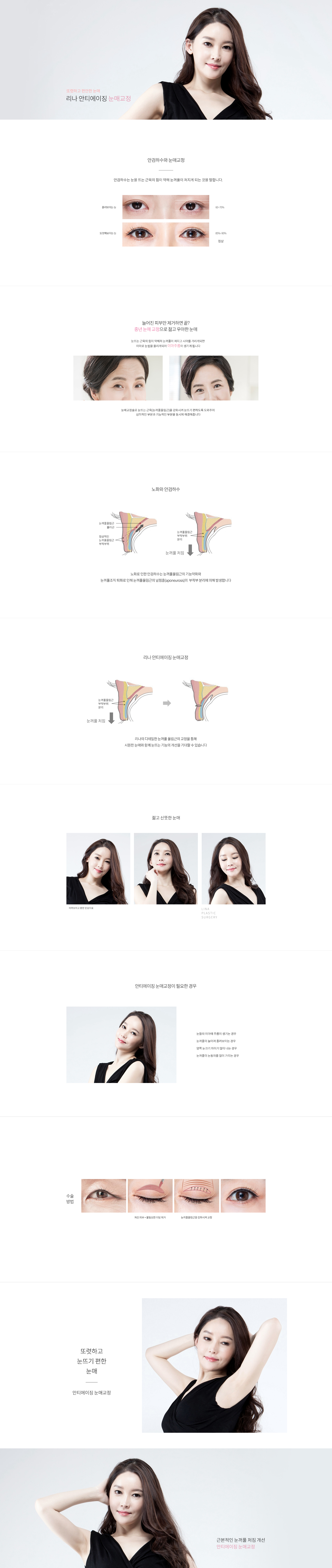 안티에이징 눈매교정