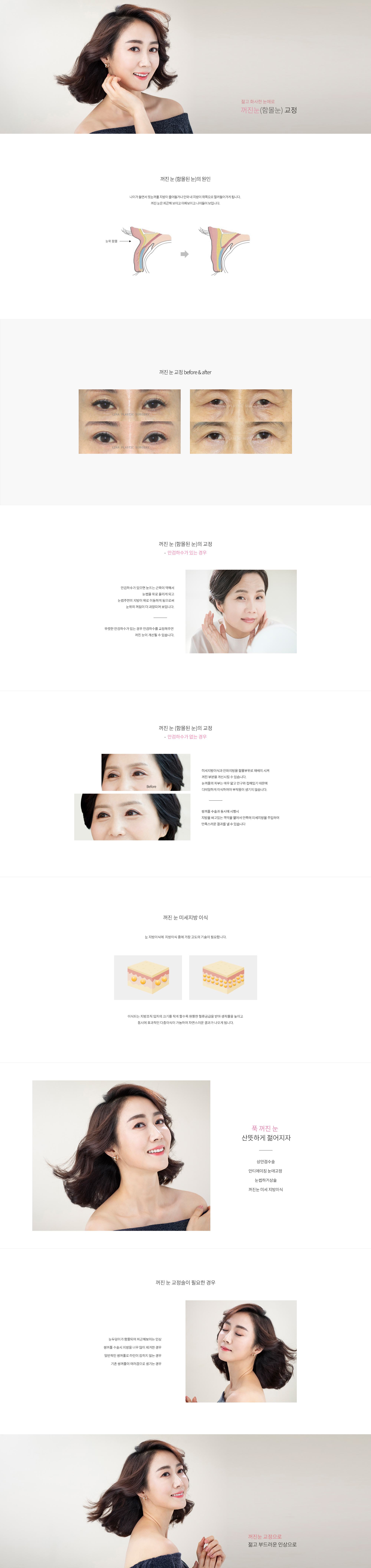 꺼진눈 교정