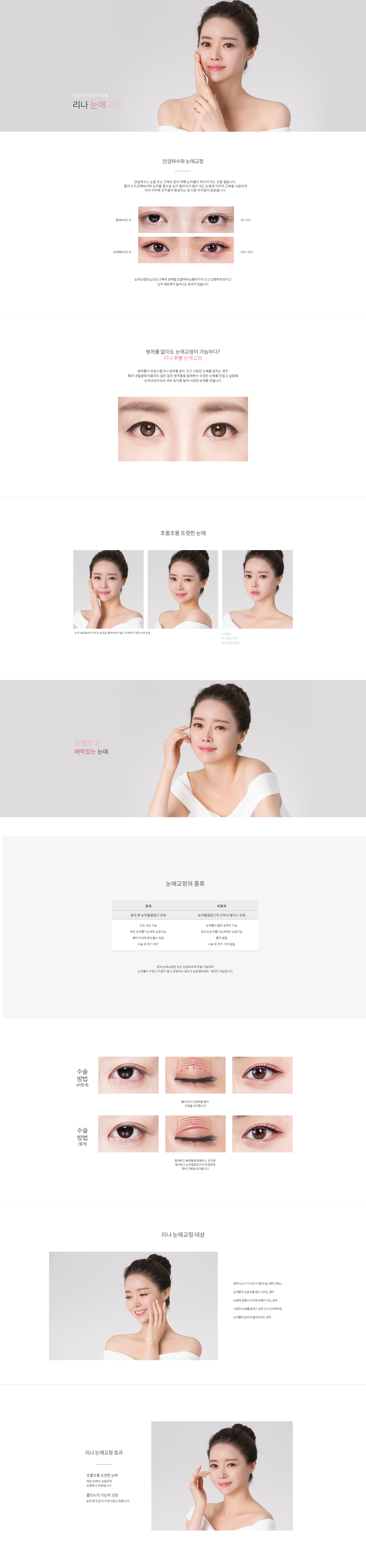 눈매교정
