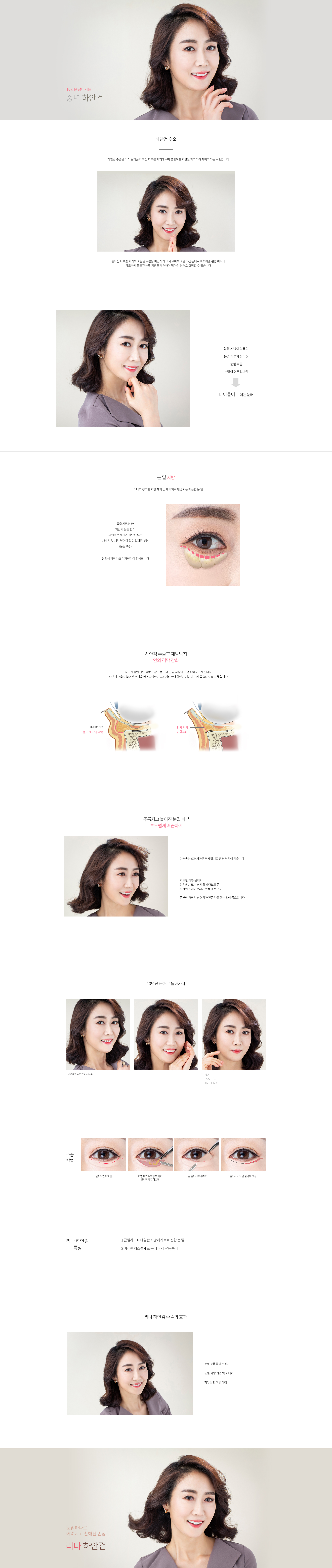 중년하안검