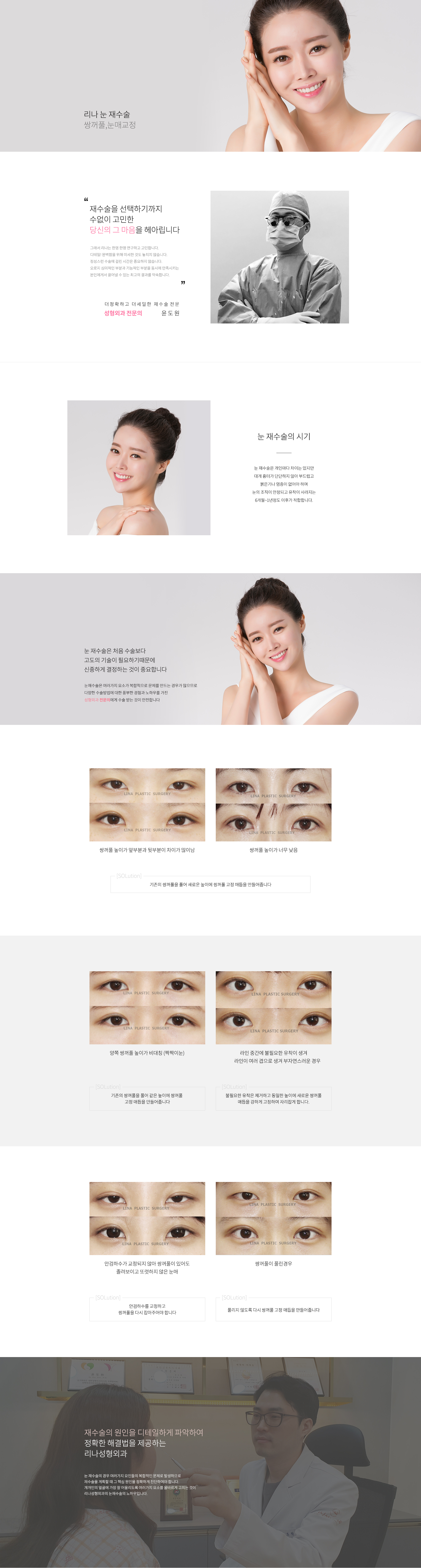 쌍커풀재수술