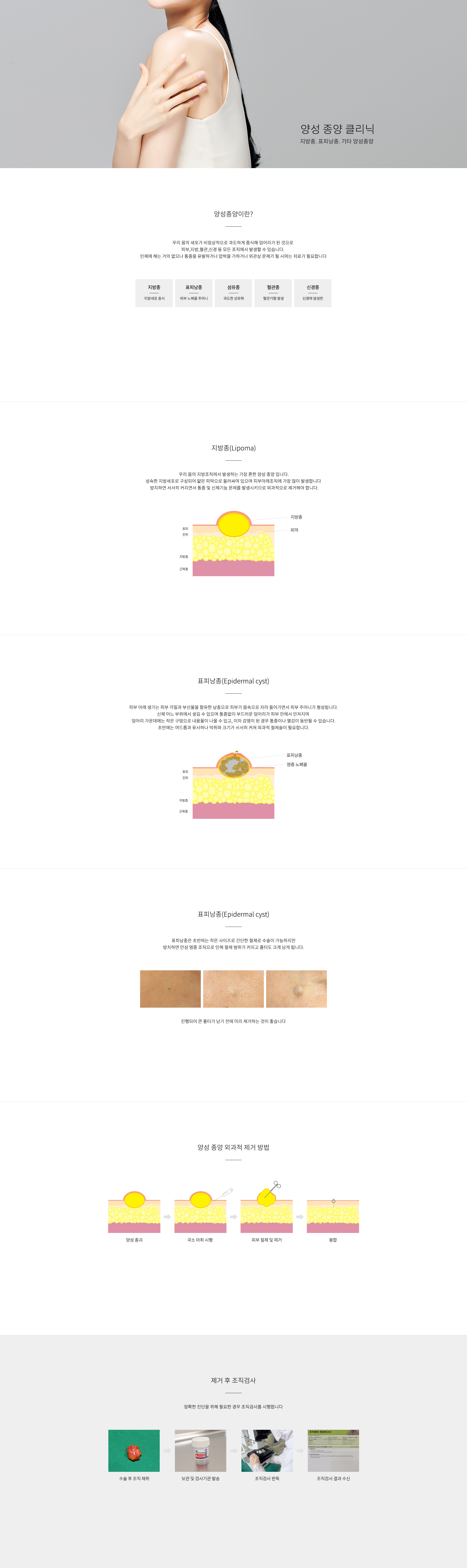 리나 양성 종양 클리닉