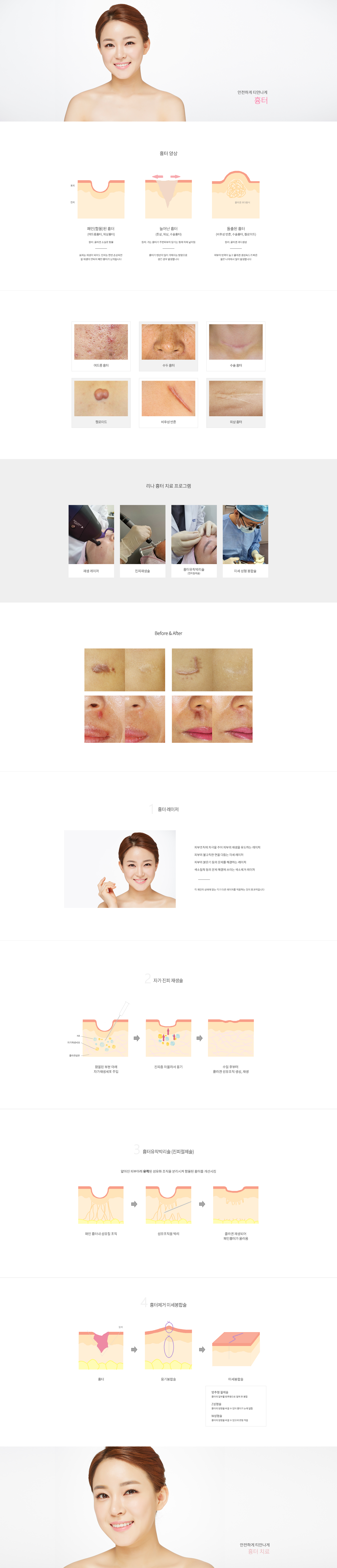 흉터상세페이지